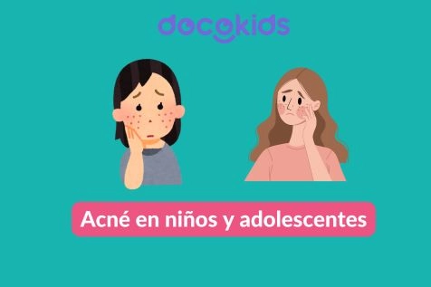 Todo lo que los padres deben saber sobre el acné en niños y adolescentes