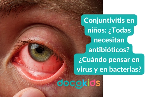 Conjuntivitis en niños: ¿Todas necesitan antibióticos? Cuándo pensar en virus y en bacterias